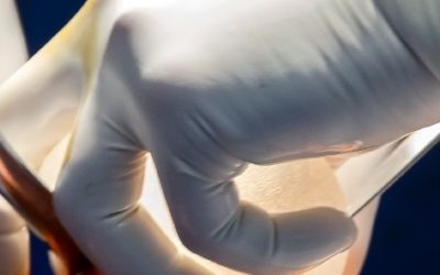 Νεφρεκτομή, ποιες είναι οι συνέπειες και οι μακροπρόθεσμες επιπτώσεις