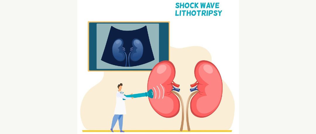 Νεφρολιθίαση – Ελάχιστα Επεμβατική Χειρουργική και η λύση της Laser Ουρητηρολιθοτριψίας