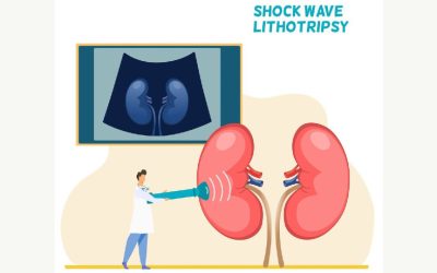 Νεφρολιθίαση – Ελάχιστα Επεμβατική Χειρουργική και η λύση της Laser Ουρητηρολιθοτριψίας